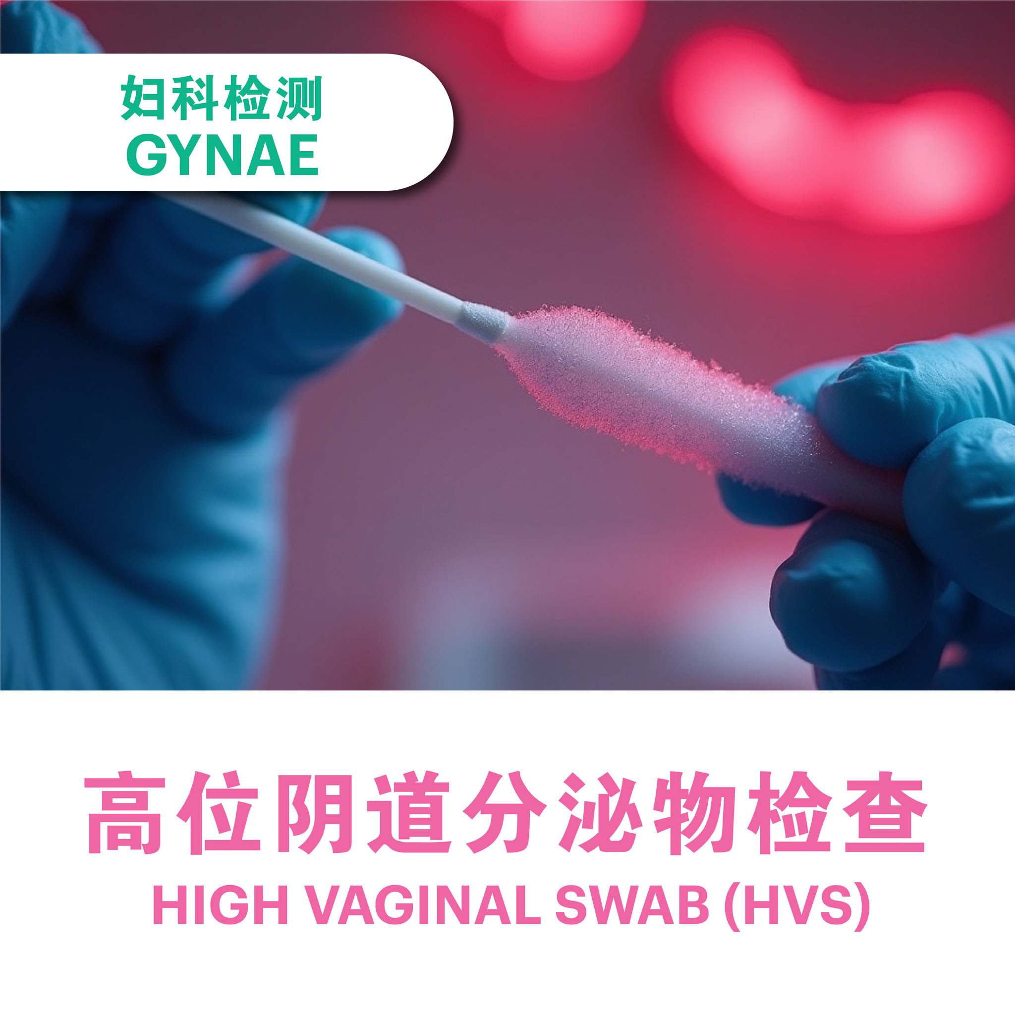 High Vaginal Swab (HVS)