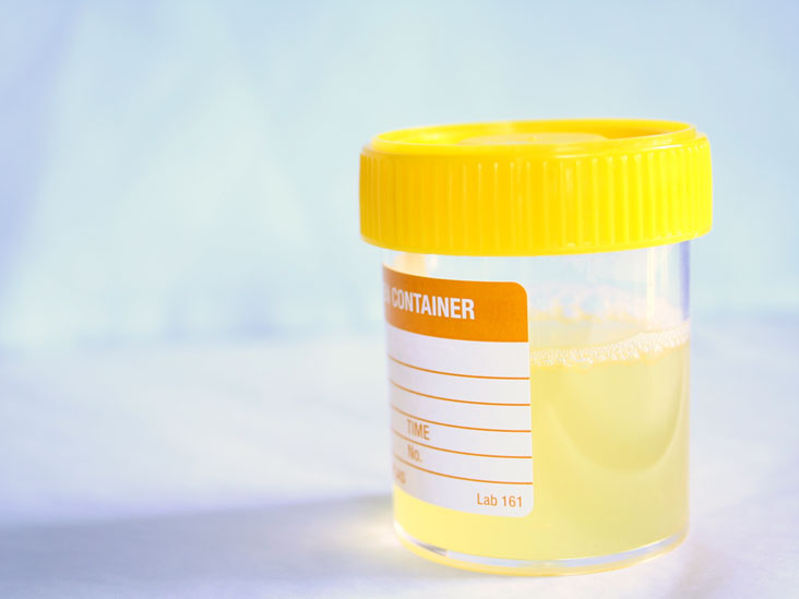 Urine Culture